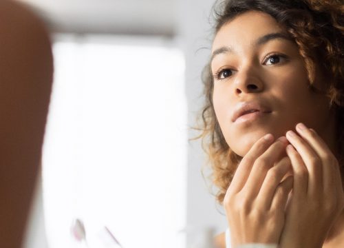 Woman checking her face in the mirror for acne and acne scarring