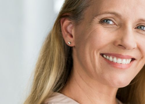 Smiling middle-age woman after ThreeForMe™ treatments
